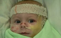 Charity Giving Online - Donate to Debra