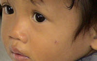 Personal fundraising pages in aid of Infantia